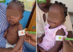 Malnutrition : 130 000 enfants haïtiens bénéficient de programmes nutritionnels soutenus par les États-Unis
