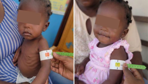 Malnutrition : 130 000 enfants haïtiens bénéficient de programmes nutritionnels soutenus par les États-Unis